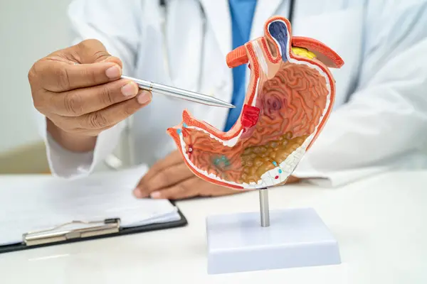 胃の病気 病院での研究診断と治療のための解剖モデルを有する医師 — ストック写真