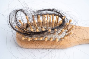 Saç dökülmesi tarakla birlikte ciddi sağlık, güzellik ve kozmetik kavramları da düştü..