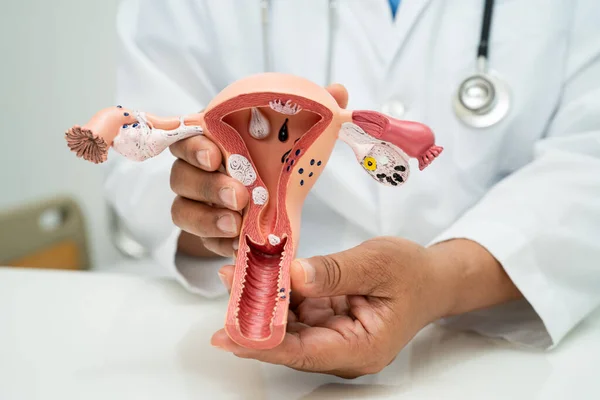 stock image Uterus, doctor with anatomy model for study diagnosis and treatment in hospital.