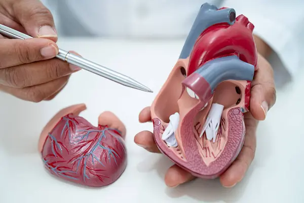 Cardiovascular disease CVD, Asian doctor holding human anatomy model for learn and treat heart disease.