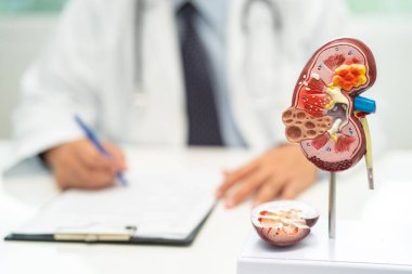 Böbrek hastalığı, kronik böbrek hastalığı, hastanede çalışmak ve tedavi etmek için insan modeli olan bir doktor..