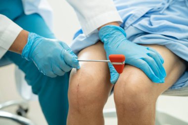 Asyalı doktor, hastanede diz reflekslerini, sinirlerini ve kaslarını kontrol etmek için çekici kullanıyor..
