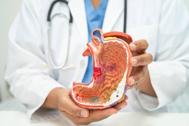 Mide hastalığı, hastanede teşhis ve tedavi için anatomi modeli olan bir doktor..