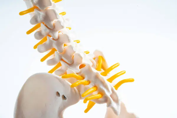 Lumbar Spine Displaced Herniated Disc Fragment Spinal Nerve Bone Model Stock Picture