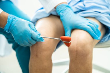 Asyalı doktor, hastanede diz reflekslerini, sinirlerini ve kaslarını kontrol etmek için çekici kullanıyor..