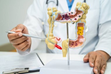 Bağırsak, apandis ve sindirim sistemi, hastanede teşhis ve tedavi için anatomi modelini tutan doktor..