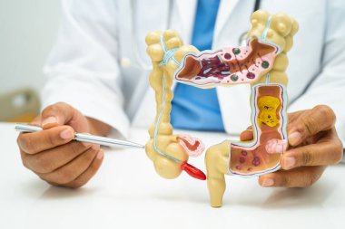 Bağırsak, apandis ve sindirim sistemi, hastanede teşhis ve tedavi için anatomi modelini tutan doktor..