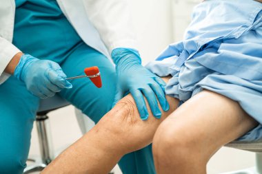 Asyalı doktor, hastanede diz reflekslerini, sinirlerini ve kaslarını kontrol etmek için çekici kullanıyor..