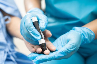 Doktor, parmak ucu ve parmak şekeri seviyesindeki şeker hastalıklarını kontrol et..