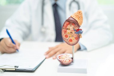 Böbrek hastalığı, kronik böbrek hastalığı, hastanede çalışmak ve tedavi etmek için insan modeli olan bir doktor..