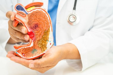 Mide hastalığı, hastanede teşhis ve tedavi için anatomi modeli olan bir doktor..