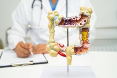 Intestine, appendix and digestive system, doctor holding anatomy model for study diagnosis and treatment in hospital. clipart