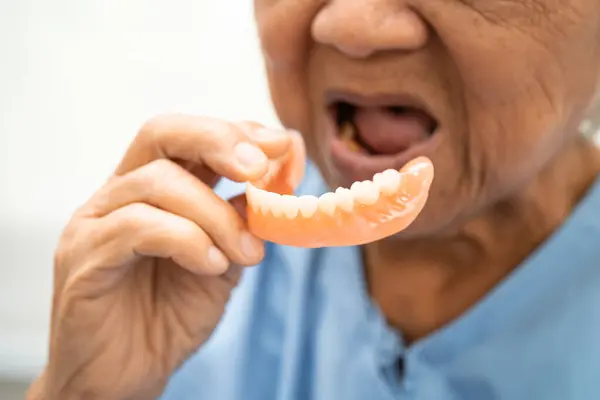 Asiático Idoso Mulher Paciente Segurando Para Usar Dentadura Saudável Forte — Fotografia de Stock
