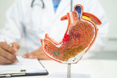 Mide hastalığı, hastanede teşhis ve tedavi için insan anatomisi modeli olan bir doktor..