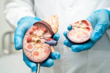 Böbrek hastalığı, kronik böbrek hastalığı, hastanede çalışmak ve tedavi etmek için insan modeli olan bir doktor..