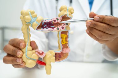 Bağırsak, apandis ve sindirim sistemi, hastanede teşhis ve tedavi için anatomi modelini tutan doktor..
