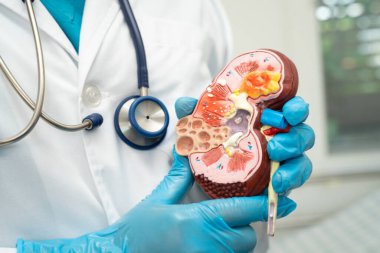 Böbrek hastalığı, kronik böbrek hastalığı, hastanede çalışmak ve tedavi etmek için insan modeli olan bir doktor..