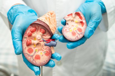 Böbrek hastalığı, kronik böbrek hastalığı, hastanede çalışmak ve tedavi etmek için insan modeli olan bir doktor..