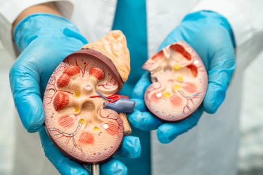 Böbrek hastalığı, kronik böbrek hastalığı, hastanede çalışmak ve tedavi etmek için insan modeli olan bir doktor..