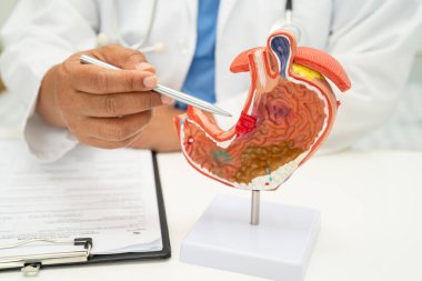Mide hastalığı, hastanede teşhis ve tedavi için insan anatomisi modeli olan bir doktor..
