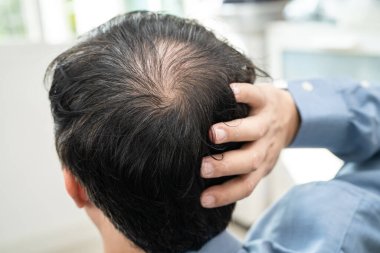 Bald in the middle head and begin no loss hair glabrous of mature Asian business smart active office man.