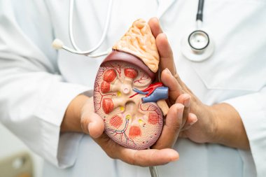 Böbrek hastalığı, kronik böbrek hastalığı, hastanede çalışmak ve tedavi etmek için insan modeli olan bir doktor..