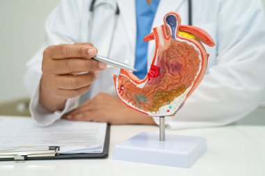 Mide hastalığı, hastanede teşhis ve tedavi için insan anatomisi modeli olan bir doktor..
