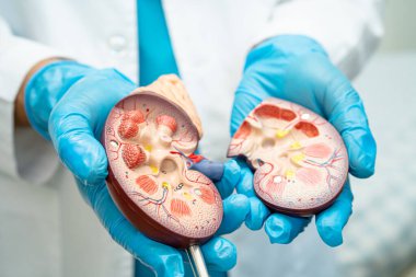 Böbrek hastalığı, Kronik Böbrek Hastalığı, Doktor, hastanede tedavi ve eğitim için insan modeli tutuyor..