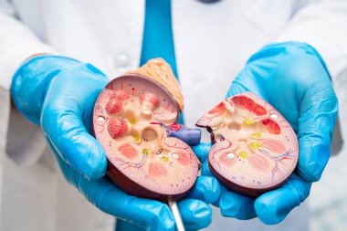 Böbrek hastalığı, Kronik Böbrek Hastalığı, Doktor, hastanede tedavi ve eğitim için insan modeli tutuyor..