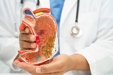 Mide hastalığı, hastanede teşhis ve tedavi için anatomi modeli olan bir doktor..