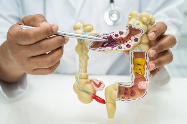 Bağırsak, apandis ve sindirim sistemi, hastanede teşhis ve tedavi için anatomi modelini tutan doktor..