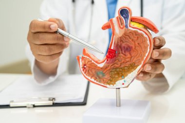 Mide hastalığı, hastanede teşhis ve tedavi için insan anatomisi modeli olan bir doktor..