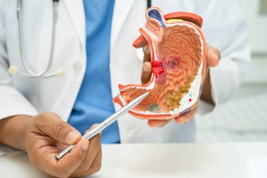 Mide hastalığı, hastanede teşhis ve tedavi için insan anatomisi modeli olan bir doktor..