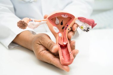 Rahim, hastanede teşhis ve tedavi için anatomi modeli olan bir doktor..