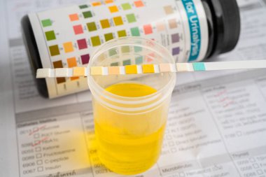 İdrar tahlili, reaksiyonlu idrar kabı. PH kağıt testi ve karşılaştırma tablosu laboratuvarda..