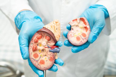 Böbrek hastalığı, Kronik Böbrek Hastalığı, Doktor, hastanede tedavi ve eğitim için insan modeli tutuyor..