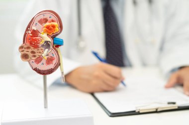 Böbrek hastalığı, kronik böbrek hastalığı, hastanede çalışmak ve tedavi etmek için insan modeli olan bir doktor..