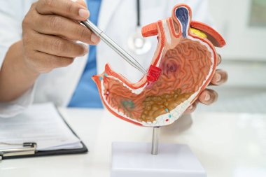 Mide hastalığı, hastanede teşhis ve tedavi için insan anatomisi modeli olan bir doktor..