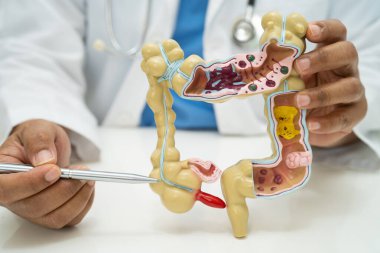 Bağırsak, apandis ve sindirim sistemi, hastanede teşhis ve tedavi için anatomi modelini tutan doktor..