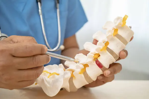 stock image Doctor with lumbar vertebra bone skeleton and nerve model for treatment in the orthopedic department.