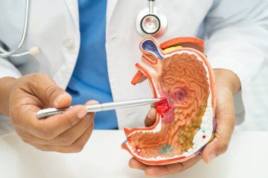 Kardiyovasküler hastalık CVD, Asyalı doktor kalp hastalıklarını öğrenmek ve tedavi etmek için insan anatomisi modeli tutuyor.