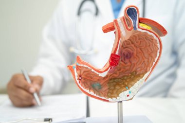 Mide hastalığı, hastanede teşhis ve tedavi için insan anatomisi modeli olan bir doktor..
