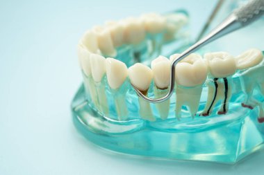 Diş hekimliği için dişçi aracı olan diş modeli.
