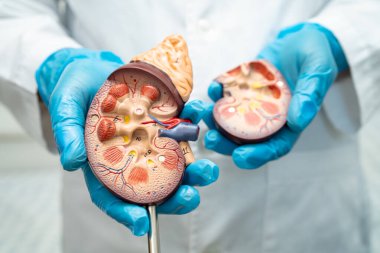 Böbrek hastalığı, Kronik Böbrek Hastalığı, Doktor, hastanede tedavi ve eğitim için insan modeli tutuyor..