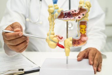 Bağırsak, apandis ve sindirim sistemi, hastanede teşhis ve tedavi için anatomi modelini tutan doktor..