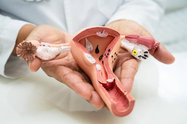 Rahim, hastanede teşhis ve tedavi için anatomi modeli olan bir doktor..