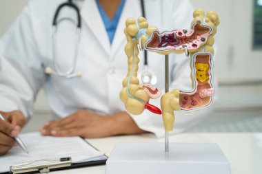 Bağırsak, apandis ve sindirim sistemi, hastanede teşhis ve tedavi için anatomi modelini tutan doktor..