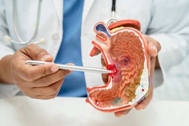 Mide hastalığı, hastanede teşhis ve tedavi için insan anatomisi modeli olan bir doktor..