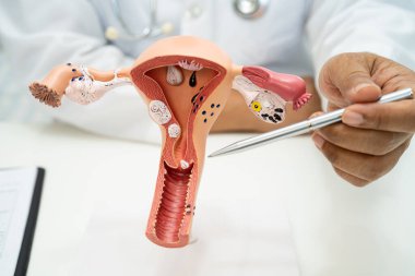 Rahim, hastanede teşhis ve tedavi için anatomi modeli olan bir doktor..