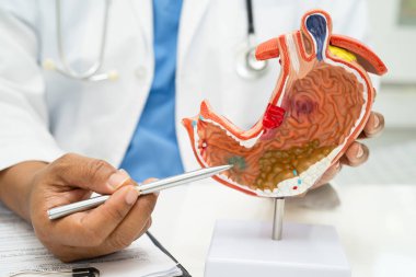 Mide hastalığı, hastanede teşhis ve tedavi için insan anatomisi modeli olan bir doktor..